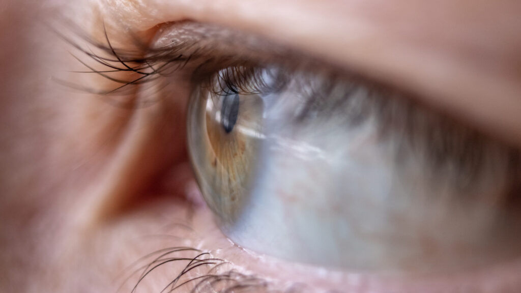 Free introduction webinar: Neuro-Ocular Release (NOR) with Richard Feely DO